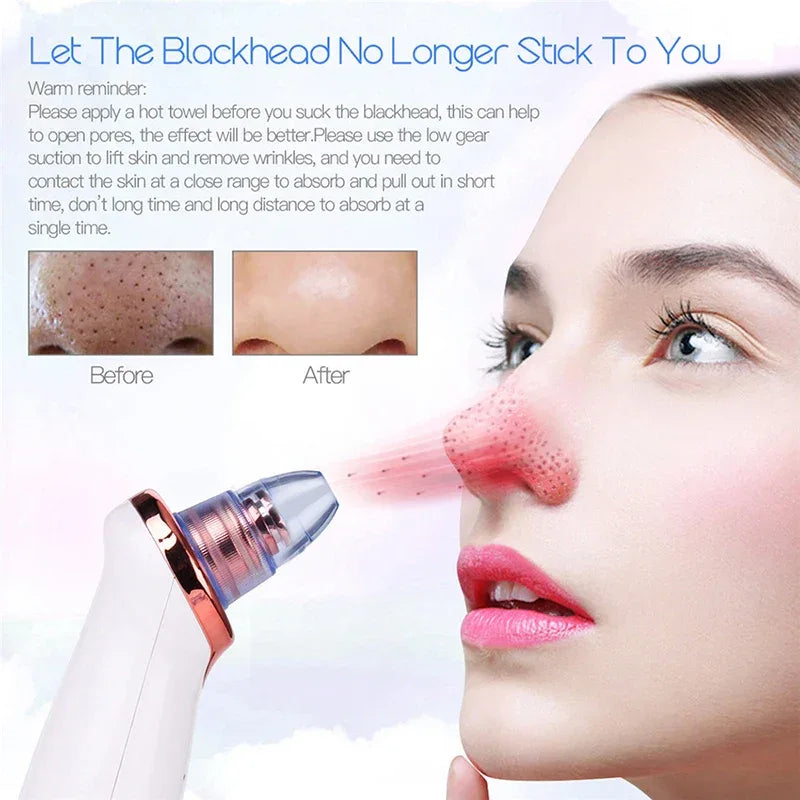 Electric Black Head Removal Face Vacuum Blackhead Instrument Blackhead Remover Vacuum Pore Cleaner - Luvia