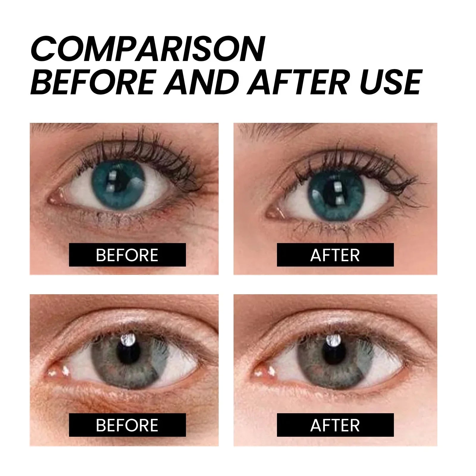 Eye Bags Cream Instant Removes Dark Circles Tightens The Eyes Lifting Firming And Removing Eye Bags Make Your Eyes More Lively