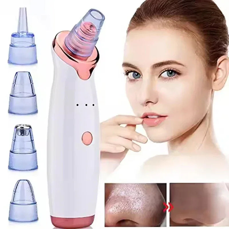 Electric Black Head Removal Face Vacuum Blackhead Instrument Blackhead Remover Vacuum Pore Cleaner - Luvia