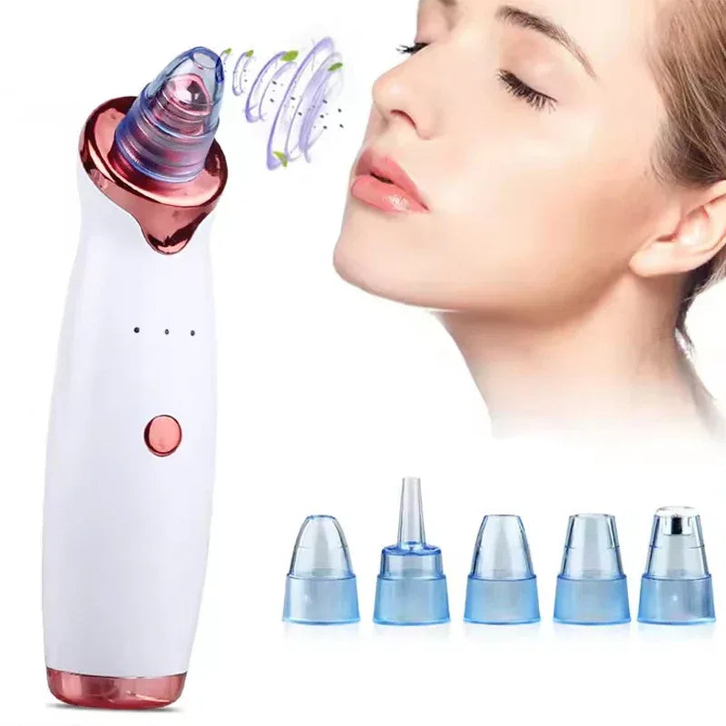 Electric Black Head Removal Face Vacuum Blackhead Instrument Blackhead Remover Vacuum Pore Cleaner - Luvia