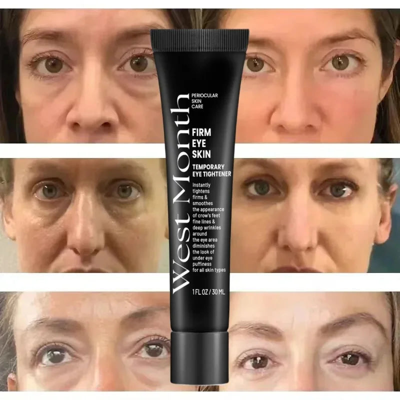 Eye Bags Cream Instant Removes Dark Circles Tightens The Eyes Lifting Firming And Removing Eye Bags Make Your Eyes More Lively