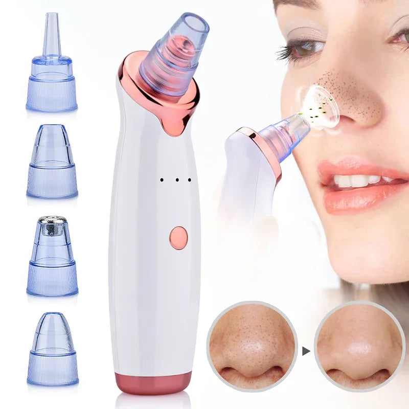 Electric Black Head Removal Face Vacuum Blackhead Instrument Blackhead Remover Vacuum Pore Cleaner - Luvia